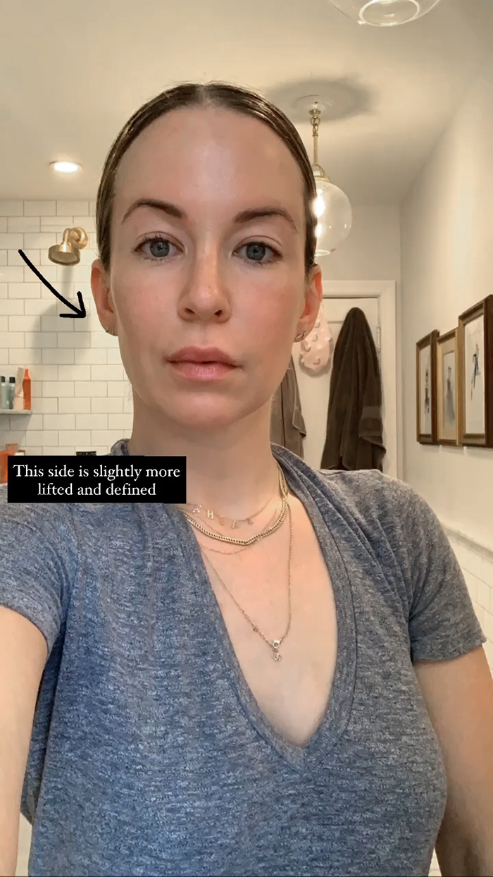 Helena Glazer showing her face after using NuFace